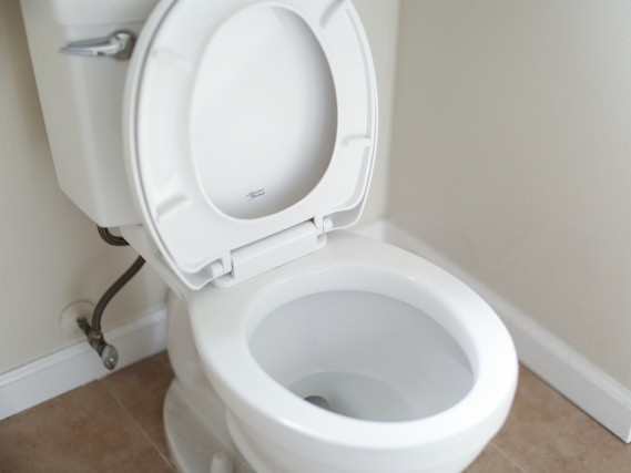 Toilette in einem Badezimmer in Essen